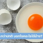 ตกขาวเยอะ