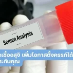 การคัดแยกเชื้ออสุจิ