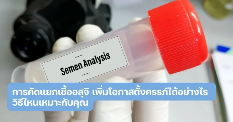 การคัดแยกเชื้ออสุจิ