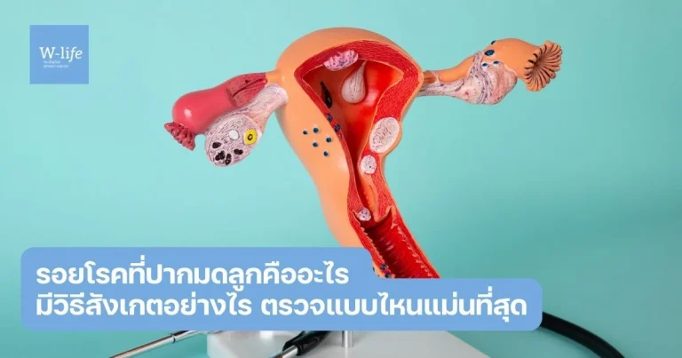 รอยโรคที่ปากมดลูกคืออะไร มีวิธีสังเกตอย่างไร