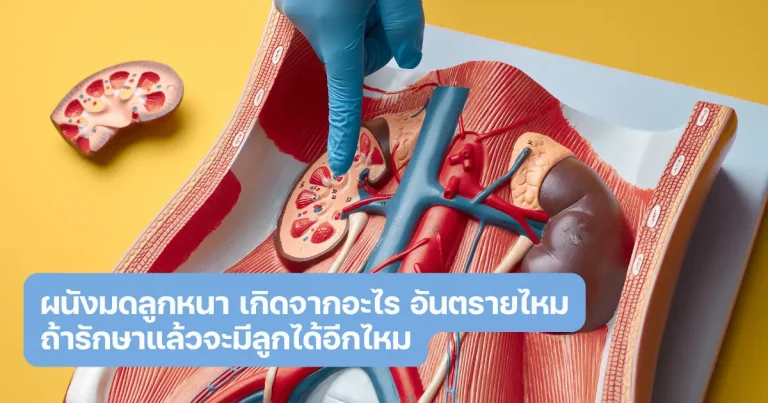 ผนังมดลูกหนา เกิดจากอะไร อันตรายไหม ถ้ารักษาแล้วจะมีลูกได้อีกไหม