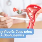 เนื้องอกมดลูก