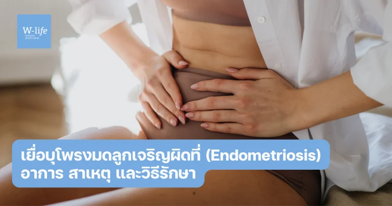 เยื่อบุโพรงมดลูกเจริญผิดที่