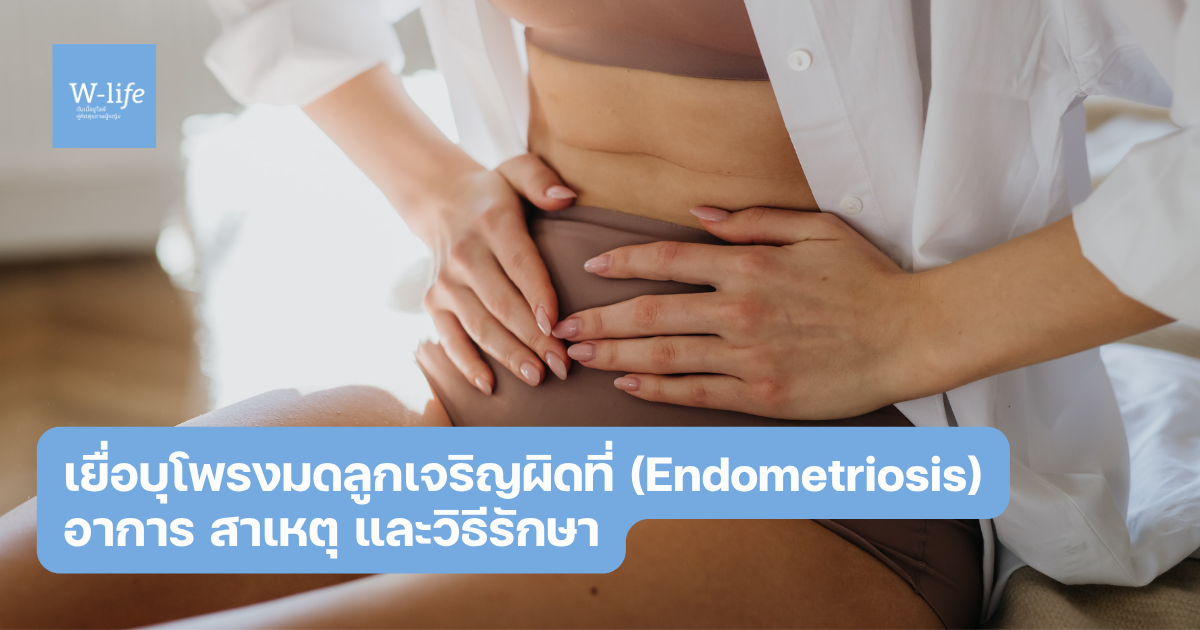 เยื่อบุโพรงมดลูกเจริญผิดที่